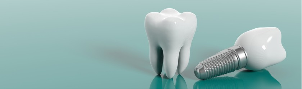 имплантация зубов стоимость